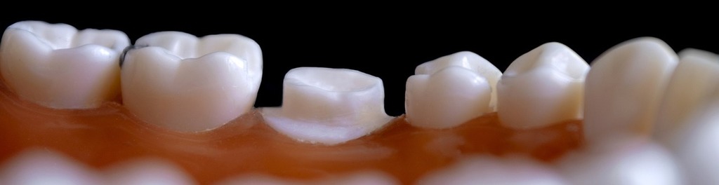Dentistry 4472925 1280